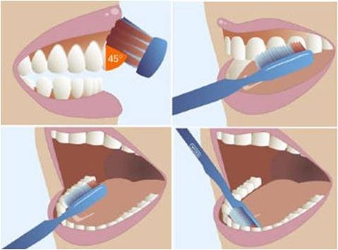 5 thói quen ảnh hưởng xấu tới răng miệng - ảnh 1