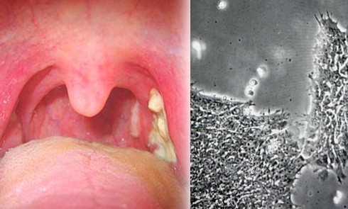 Phát hiện virut khiến con người ngốc nghếch - ảnh 1