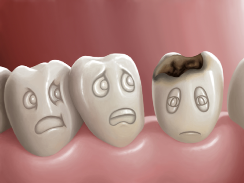 Điểm mặt các bệnh răng miệng thường gặp - ảnh 1