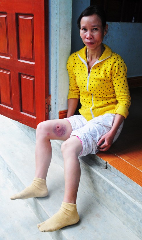 Quảng Ngãi: Xem pháo hoa đêm giao thừa, nhiều người nhập viện - ảnh 2