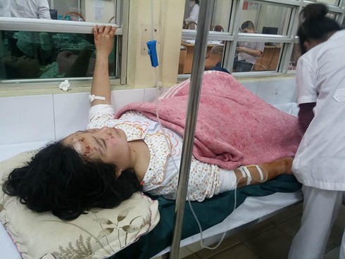 Miễn toàn bộ chi phí cứu chữa nạn nhân của vụ nổ lớn ở Hà Đông - ảnh 1