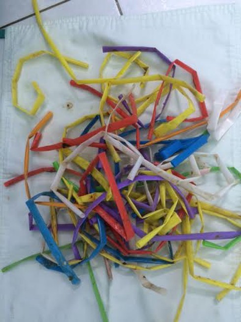 Cấp cứu bệnh nhân nuốt...47 ống hút vào dạ dày - ảnh 1