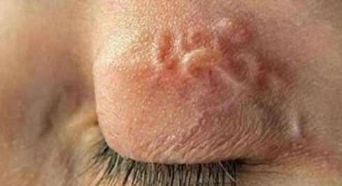 Triệu chứng khi nhiễm giun - ảnh 1