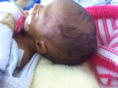 Những sự cố y khoa làm phiền lòng người bệnh - ảnh 2