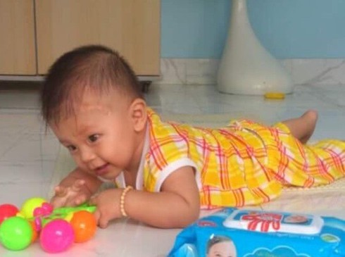 Ảnh thôi nôi khỏe mạnh của bé bị đâm xuyên não - ảnh 3