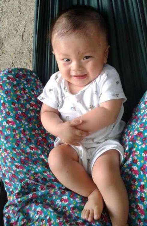 Ảnh thôi nôi khỏe mạnh của bé bị đâm xuyên não - ảnh 2