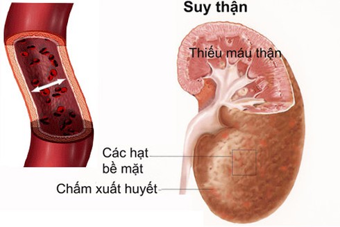Thận yếu, cả nam và nữ đều bị ảnh hưởng đến đời sống tình dục - ảnh 1