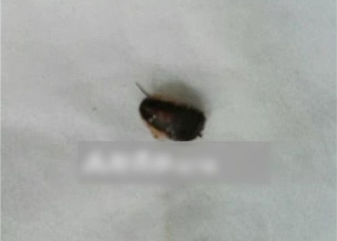 Tự xịt thuốc diệt côn trùng vào lỗ tai để giết gián - ảnh 2