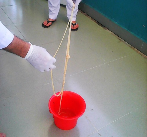 Kinh dị sán xơ mít dài hơn 5 mét sống trong ruột cụ bà - ảnh 1