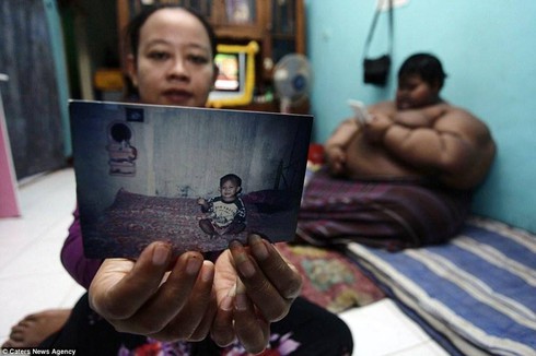 Cậu bé béo nhất thế giới phải phẫu thuật cắt dạ dày - ảnh 2