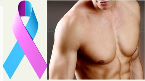 Tìm hiểu về bệnh ung thư vú ở nam giới