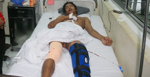 Đà Nẵng: Đang uống cà phê thì bị truy sát