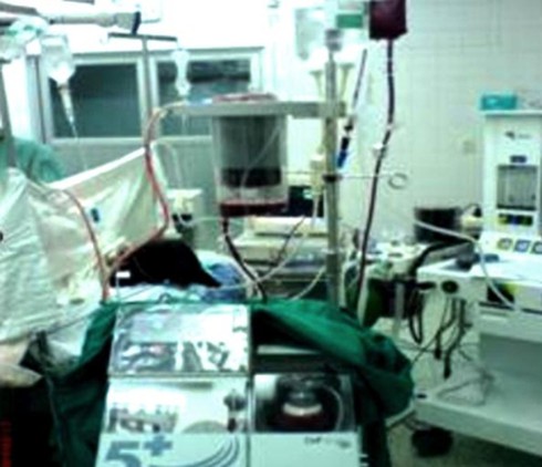 Truyền máu hoàn hồi: `Cứu tinh` mới cho người bệnh