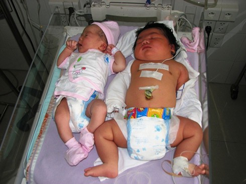 TP.HCM: Bé sơ sinh cân nặng 6 kg