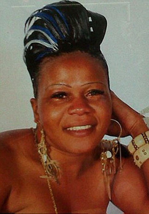 Anh: Tử vong chỉ vì nối tóc