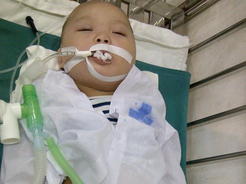 Bé 9 tháng tuổi thùng ruột vì ăn cháo có xương