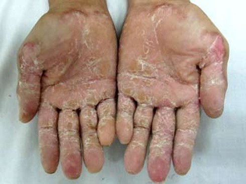 Bộ Y tế kiểm tra bệnh lạ tại Quảng Ngãi