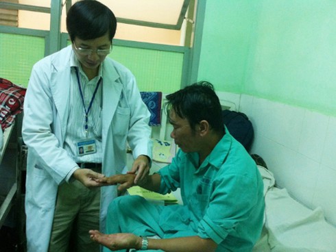 Mất chân vì hút thuốc