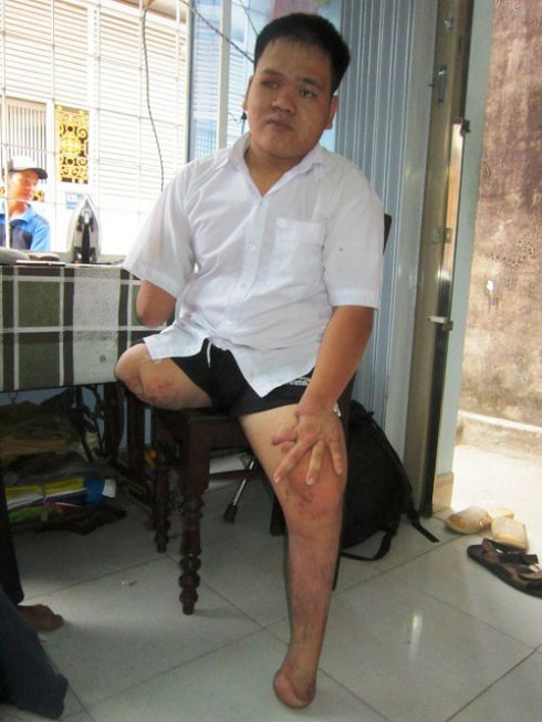 Sĩ tử ngồi xe lăn khiến hội đồng thi cảm động