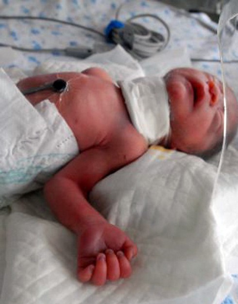 Bé gái sơ sinh bị cắt cổ, vứt thùng rác ở TQ