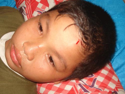 Tên cuồng sát chém gần 20 người