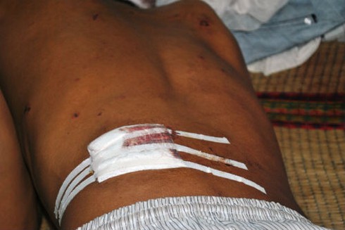 Giây phút sinh tử trong vụ sập hầm thủy điện