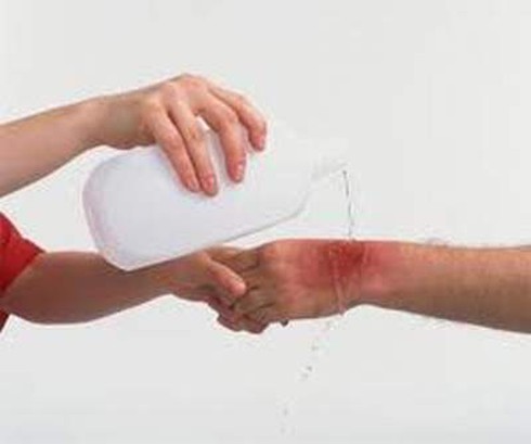 Côn trùng đốt - Chớ xem thường