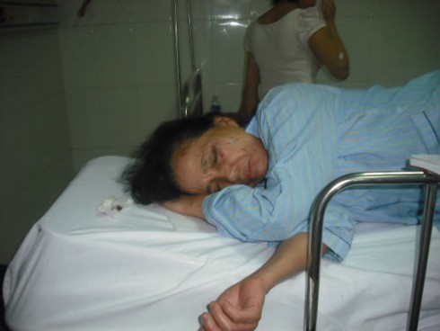 Nạn nhân kể lại phút kinh hoàng bên bờ vực thẳm