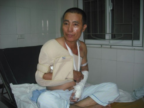 Nạn nhân kể lại phút kinh hoàng bên bờ vực thẳm