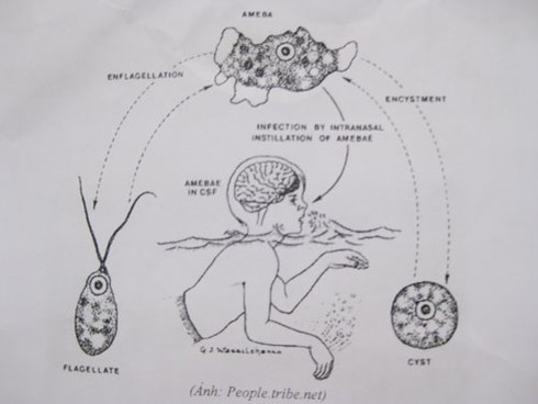 Việt Nam xuất hiện 'amip ăn não người'