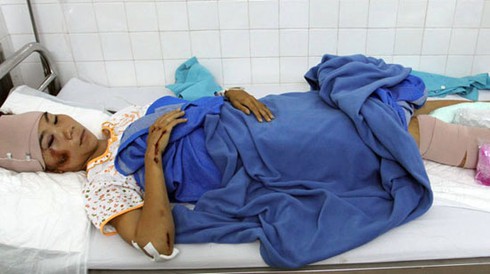 “Nữ hoàng điền kinh” gặp TNGT, chấn thương nặng