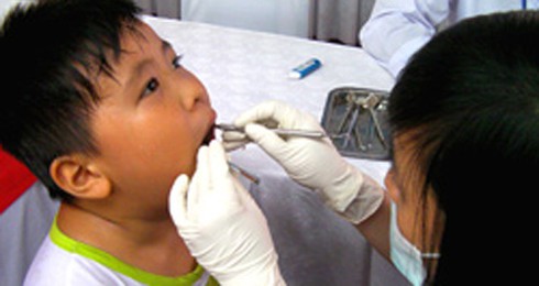 85% trẻ nhỏ sâu răng sữa