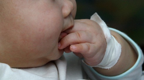 Nhiễm khuẩn từ móng tay