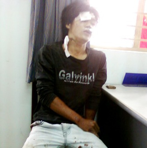 Vụ tên cướp đâm cảnh sát: Một người đã tử vong