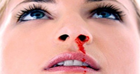 Có thể chết vì chảy máu cam?
