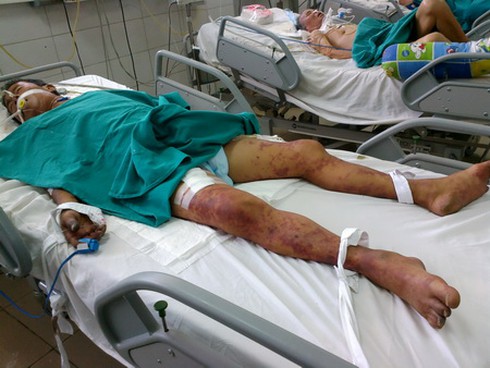 Tiết canh động vật: Ổ virus cực độc gây chết người