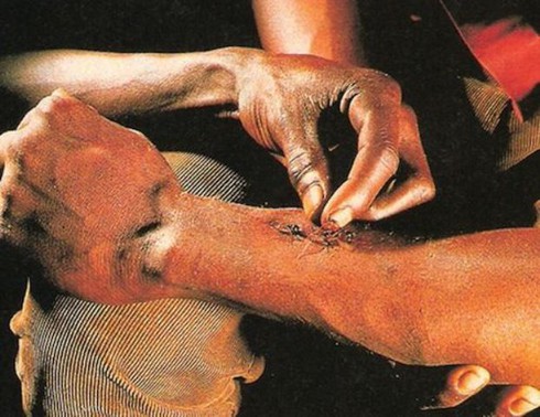 Dùng kiến để khâu vết thương - ảnh 1