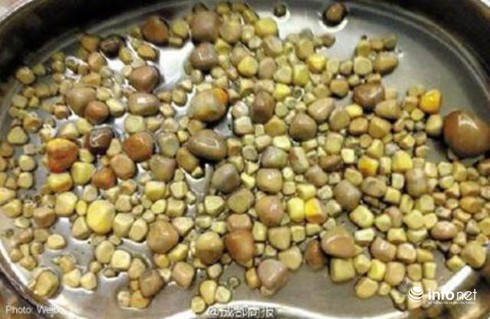 Sốc: Phát hiện 420 viên sỏi trong thận một bệnh nhân - ảnh 1