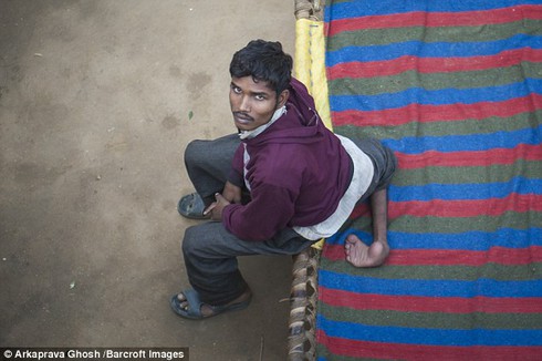 Indian boy miserable because of living with 4 legs - photo 1