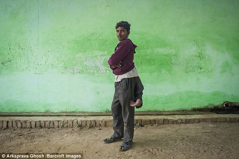 Indian boy miserable because of living with 4 legs - photo 2