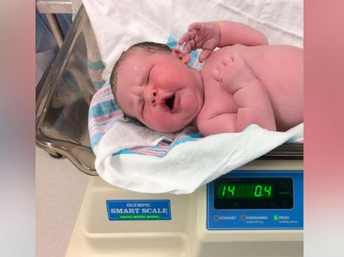 Y tá ngạc nhiên đón cậu bé chào đời đã nặng 6,3kg - ảnh 1