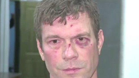 Ứng cử viên Tổng thống Ukraine bị 'đánh đập dã man' - ảnh 1