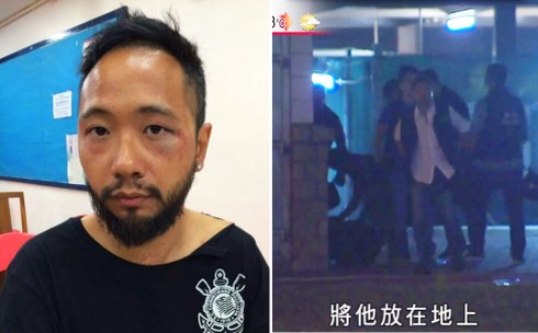 Hong Kong: Cảnh sát đấm đá người biểu tình? - ảnh 2