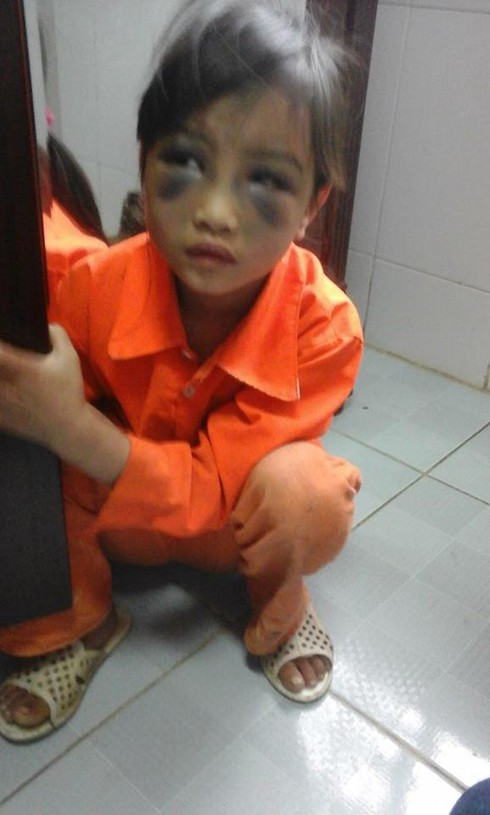 Shop TIN 31/3: Dân ta từ chán sang ngấy- Quan Sở: