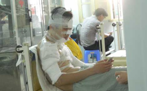 Nam sinh bị tạt axít vì mối tình tay ba... - ảnh 1