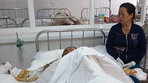 Tin mới về vụ tạt xăng, đốt quán cà phê ở Quy Nhơn - ảnh 1