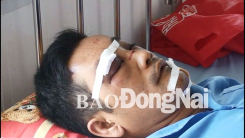 Truy bắt kẻ kéo côn đồ đến chém trọng thương bạn trai của vợ cũ - ảnh 1