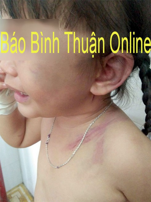 Hàm Tân: Làm rõ cha dượng hành hạ dã man con vợ 3 tuổi - ảnh 1