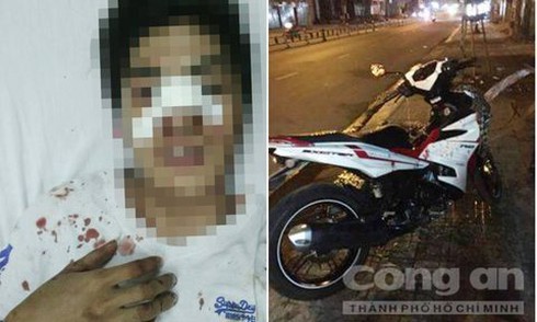 Hai dân phòng ‘đấu’ 7 tên cướp có hung khí, bình xịt hơi cay để cứu người - ảnh 2