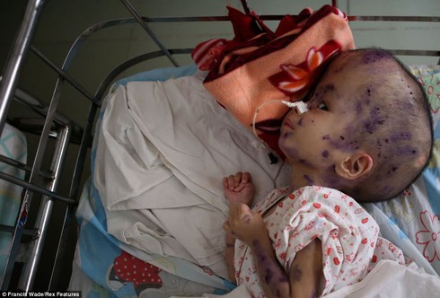 Báo Anh: Những 'nỗi đau da cam' ở Việt Nam khiến tim bạn 'tan chảy' - ảnh 1